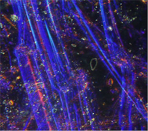 Chrysotile Figure 1