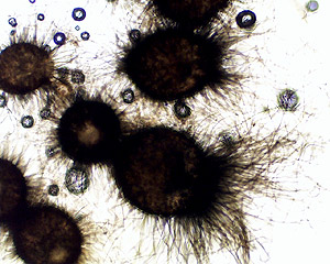 The fruiting bodies of Chaetomium are covered with long hairs.