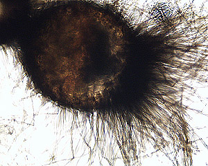The fruiting bodies of Chaetomium are covered with long hairs.