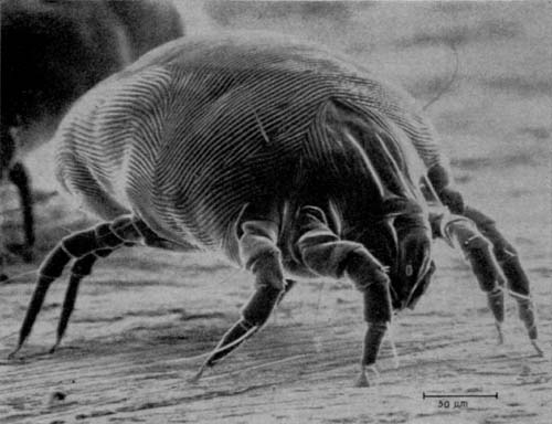 Magnified photograph of a house dust mite