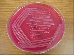 E. coli growth on McConkey agar