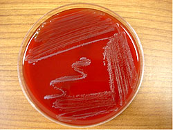 Enterococcus spp. growth in TSA agar