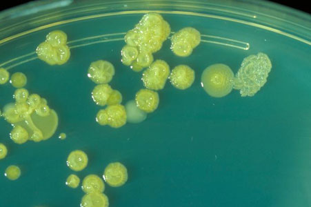 Enterobacter sakazakii