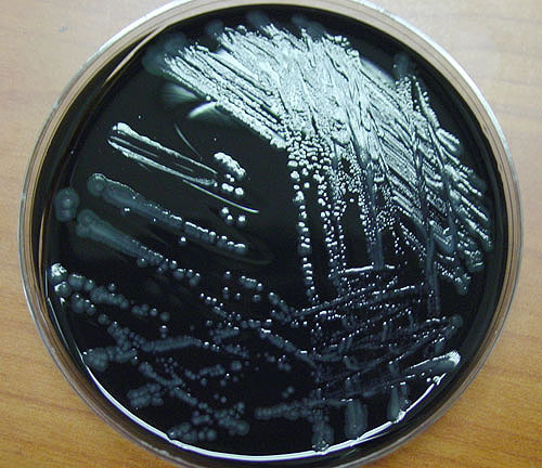 Legionella on contact plate