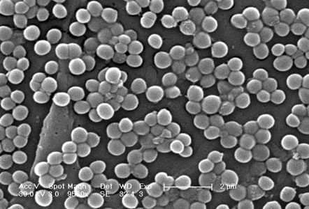 Methicillin-resistant <em>Staphylococcus aureus