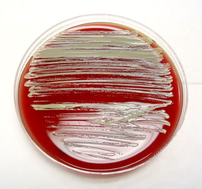 Micrococcus yellow pigmentation on nutrient agar