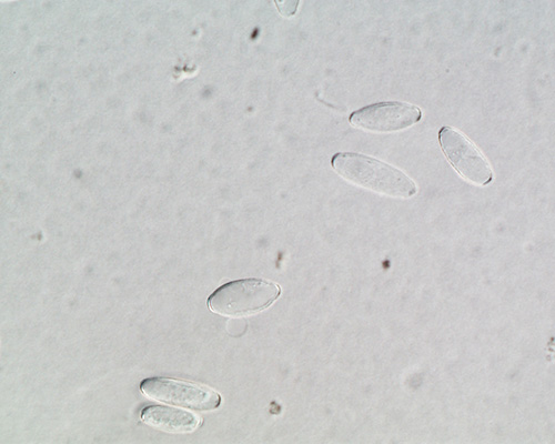 Microphoto of Oidium spores from a spore trap sample