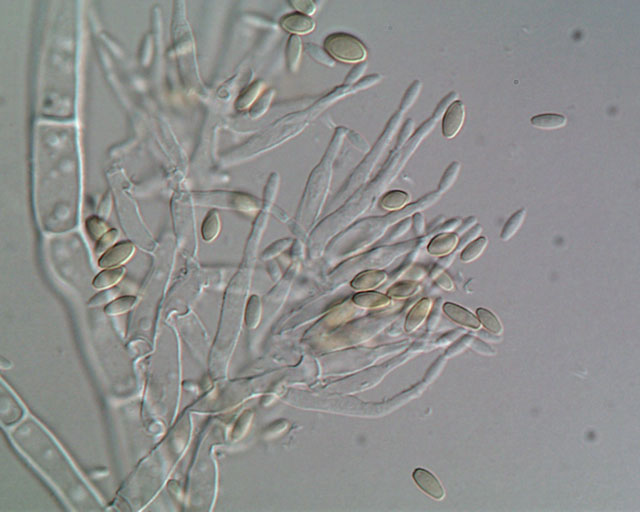 Microphoto of Paecilomyces