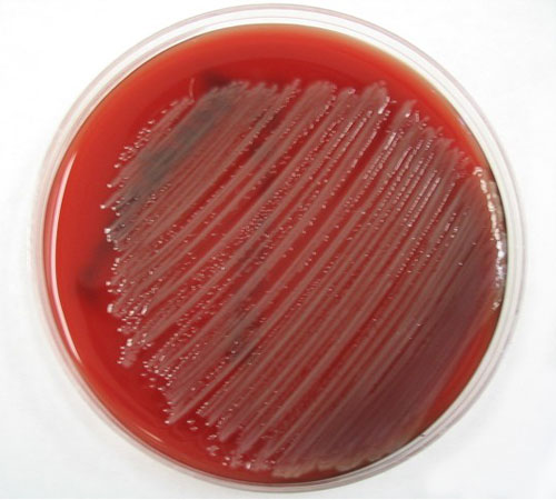 Pseudomonas aeruginosa on Trypic Soy Agar (TSA).
