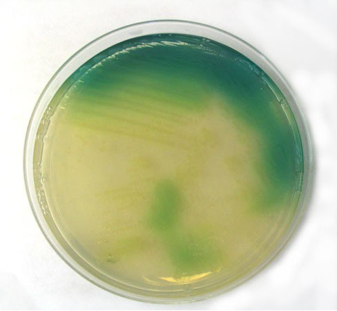 Pseudomonas aeruginosa in Pseudomonas Isolation Agar.
