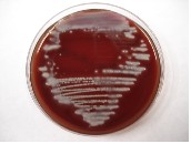 Pseudomonas aeruginosa growth on Tryptic Soy Agar plate