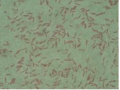 Gram stain of Pseudomonas aeruginosa