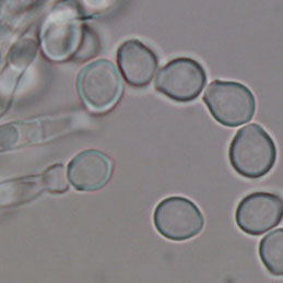 Close up view of distinctive Scopulariopsis spores
