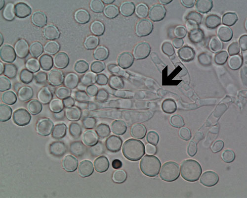 Scopulariopsis spores growing from a scopula (arrow)