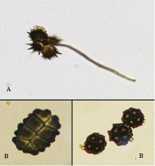 Spegazzinia spores