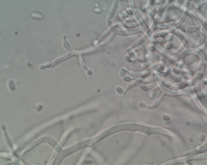 Microscopic photo of Trichoderma with Conidiophores and Conidia