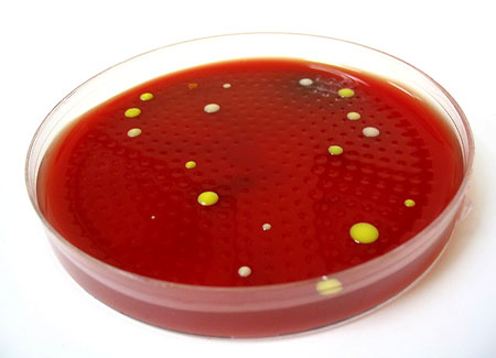Air sample from indoor environment