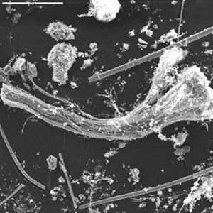 Chrysotile bundle from World Trade Center dust.