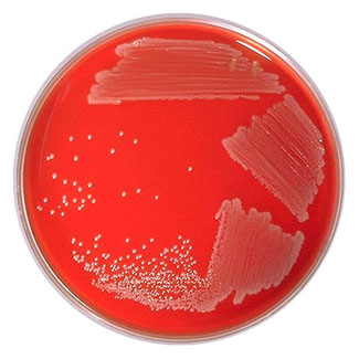 Corynebacterium colonies on blood agar.