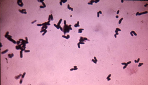 Gram stain of Corynebacterium.