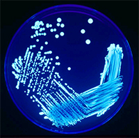 Legionella sp. Colonies on Agar Cultured Plate, Illuminated with UV Light