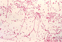 Gram-stained Micrograph of Legionella pneumophila Bacteria